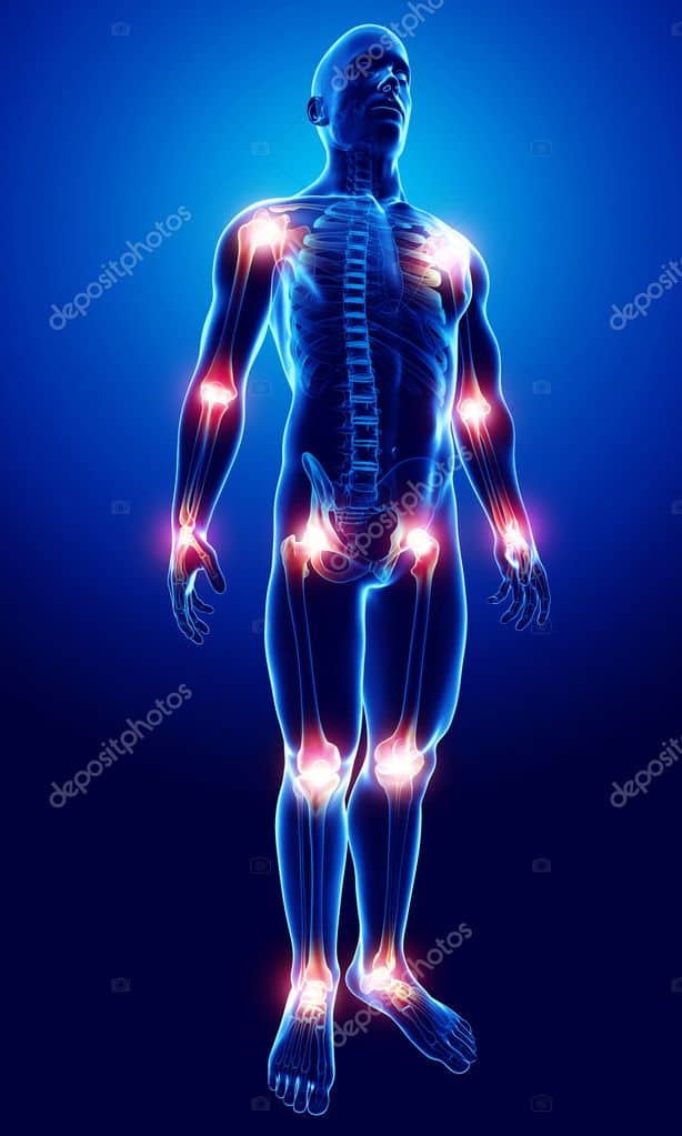 Depositphotos 22675667 Stock Photo Joint Pain Antomy
